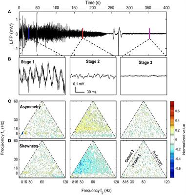 Spectrum Degradation of Hippocampal LFP During Euthanasia